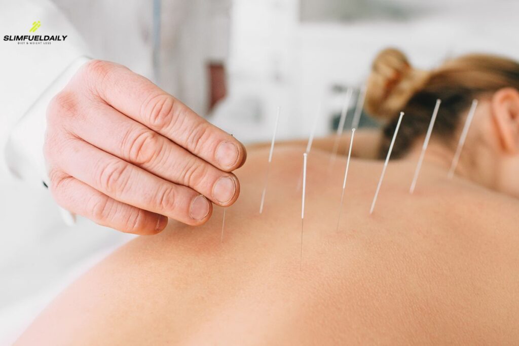 acupuncture weight loss ireland