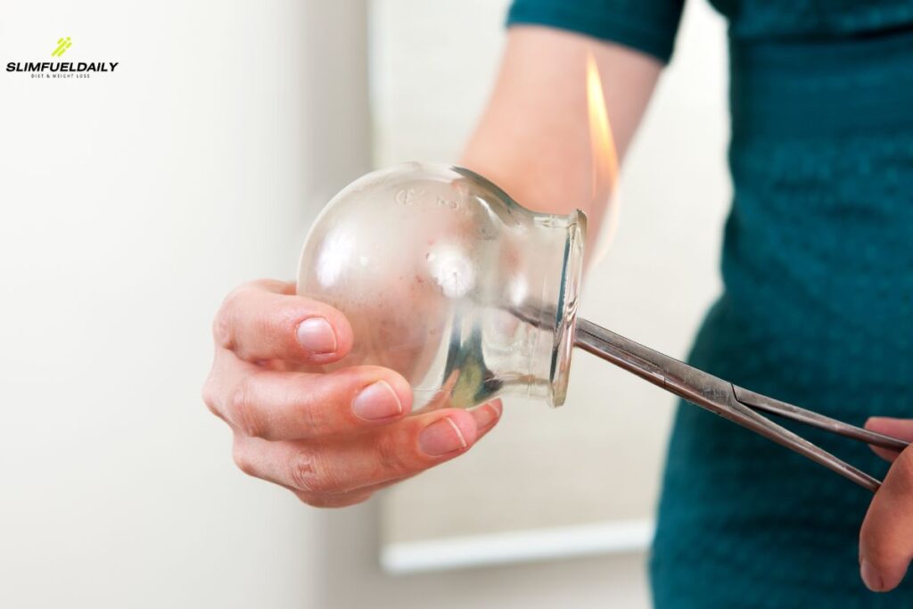 can cupping help weight loss